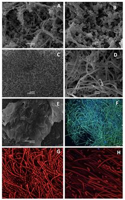 Biofilms in hoses utilized to divert colostrum and milk on dairy farms: A report exploring their potential role in herd health, milk quality, and public health